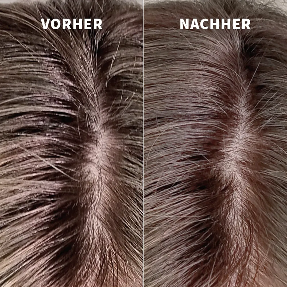 Fettiger Haaransatz wird sichtbar erfrischt und wirkt nach der Anwendung sauber, leicht und gepflegt